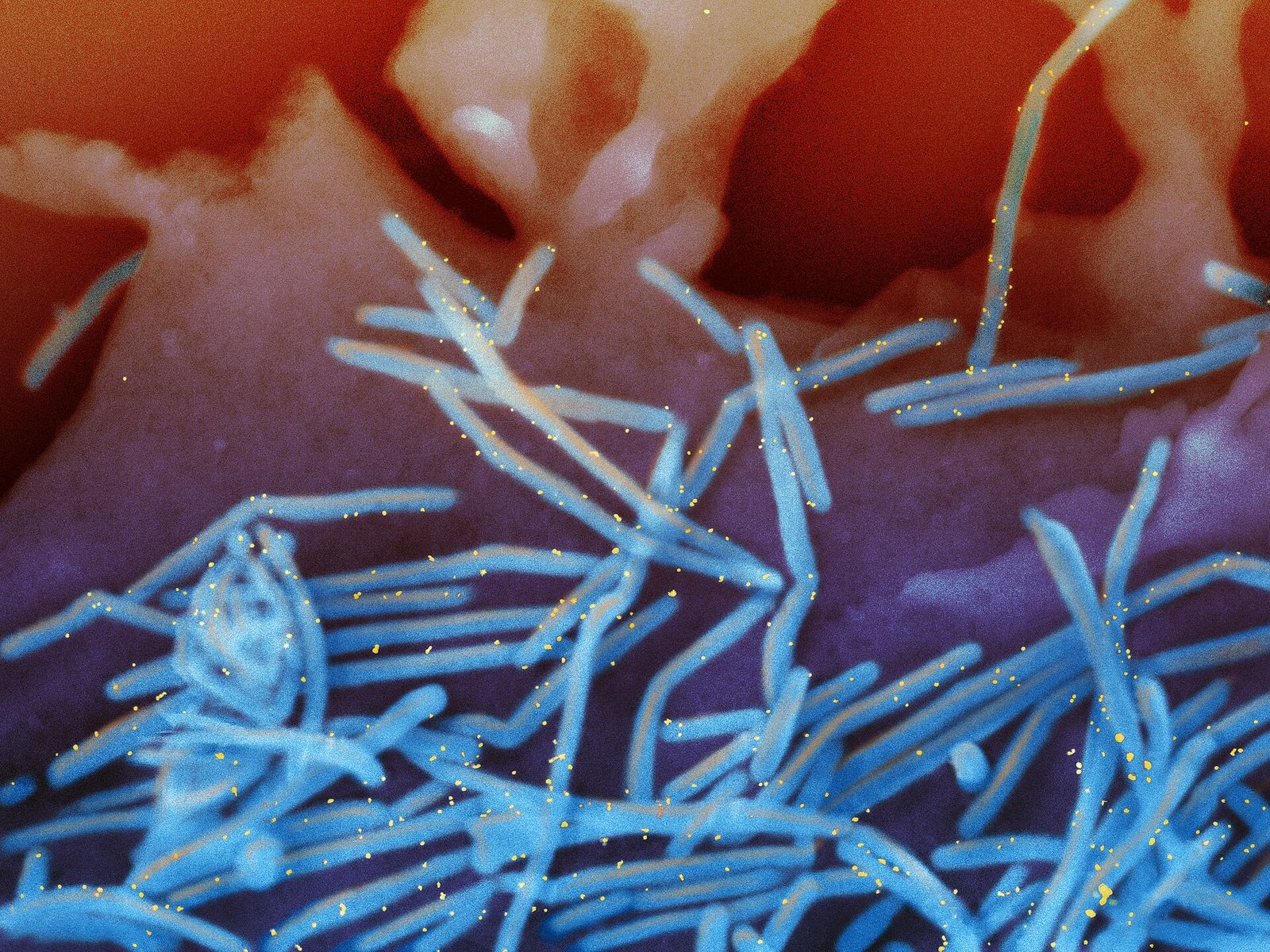 Colorized scanning electron micrograph of respiratory syncytial virus particles (blue) budding from human lung cells — illustrative